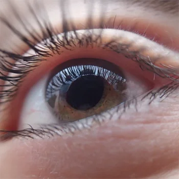 Eye Doctor Plainfield IL Keratoconus BOX A photo of an eye, showing details of the iris and eye lashes